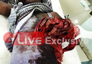 ভোট দিতে গিয়ে আহত আরও এক ।